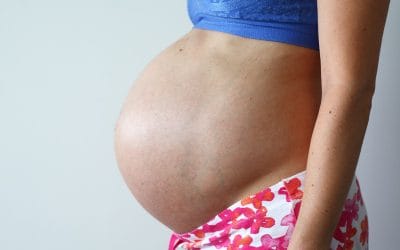 When Pregnancy Veins Won’t Go Away