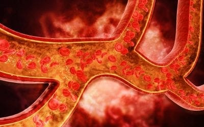 Everything You Need to Know About DVTs: Signs, Symptoms, and Treatment