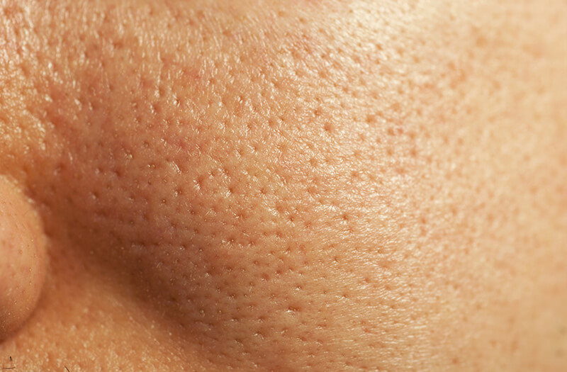Skin-Pores