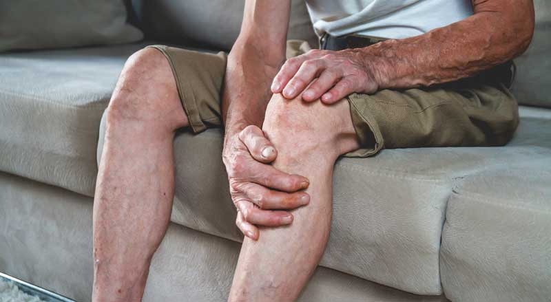 An older man sitting on a sofa holding one of his legs which have obvious varicose veins