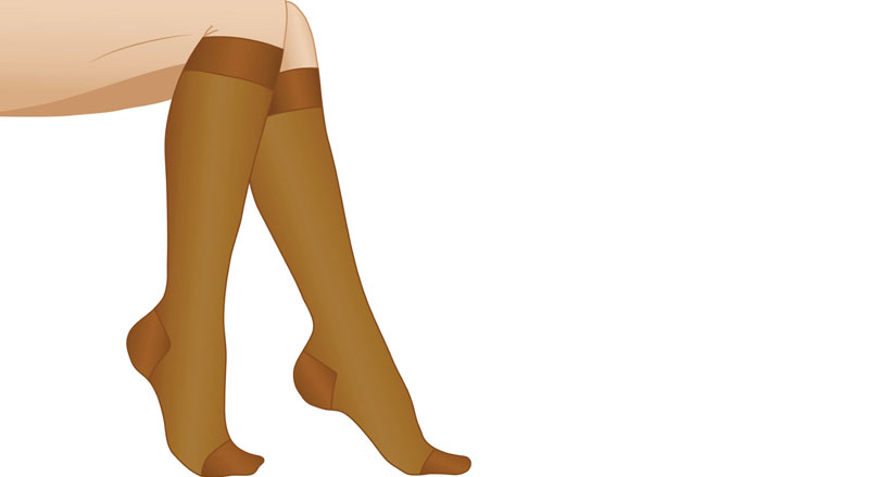Compression socks on a woman’s legs