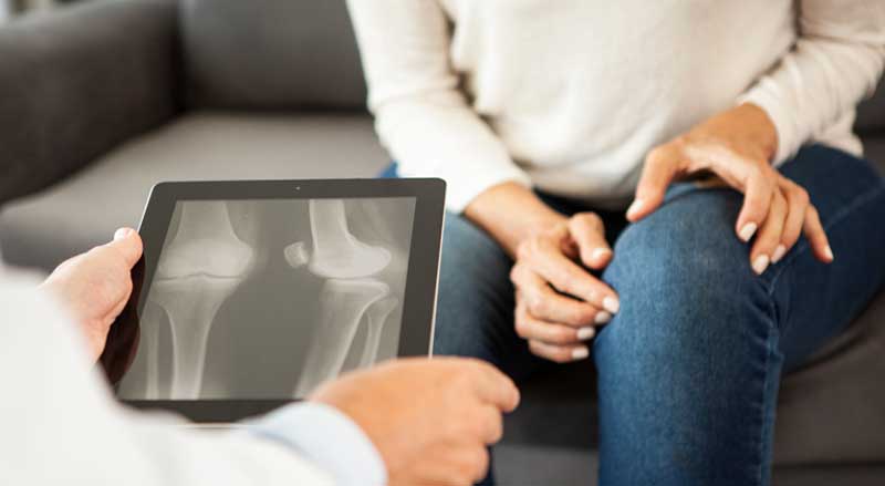 A woman is holding her knee as orthopedic doctor looks at her X-ray